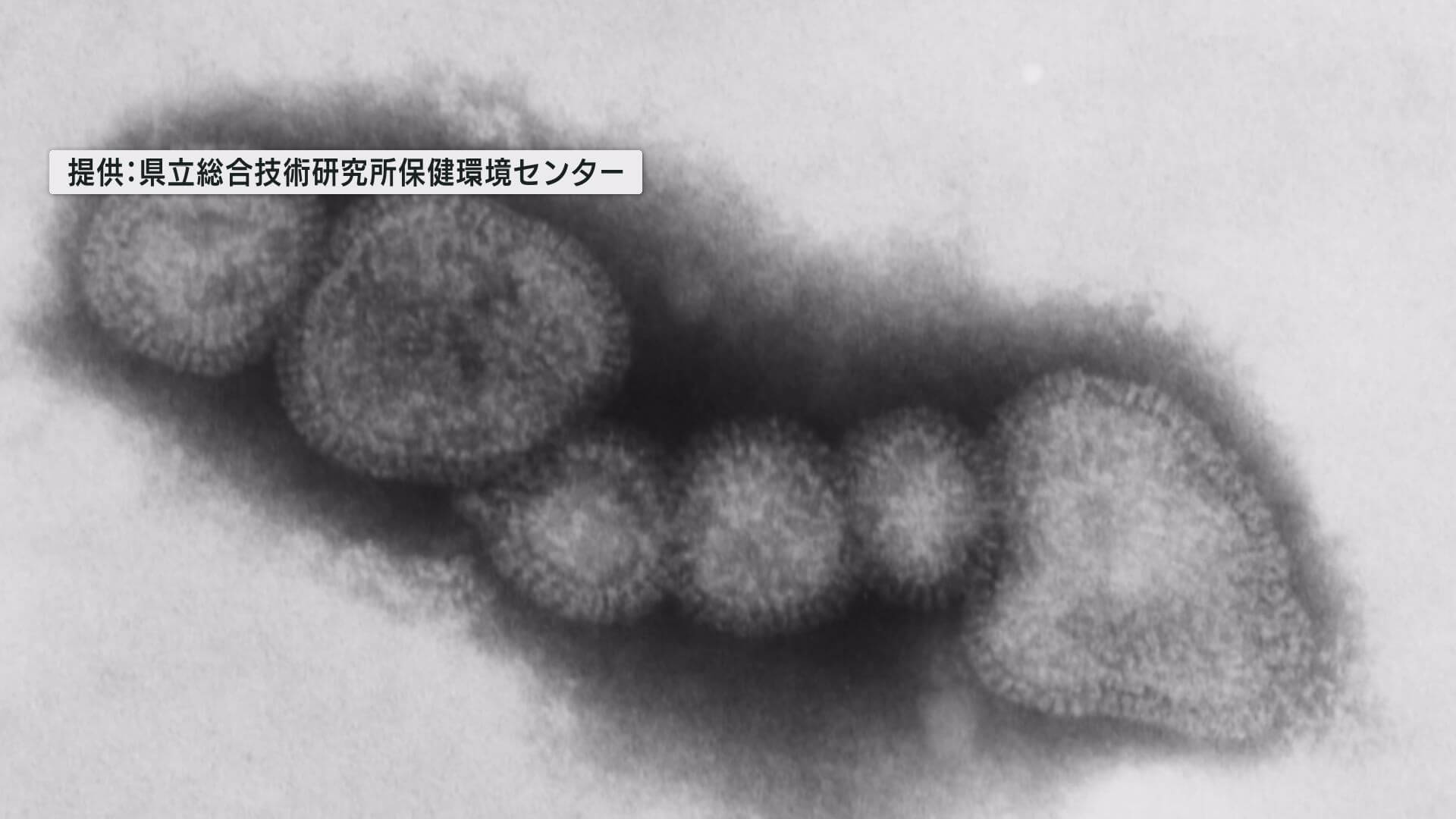 広島市でインフルエンザ流行入り