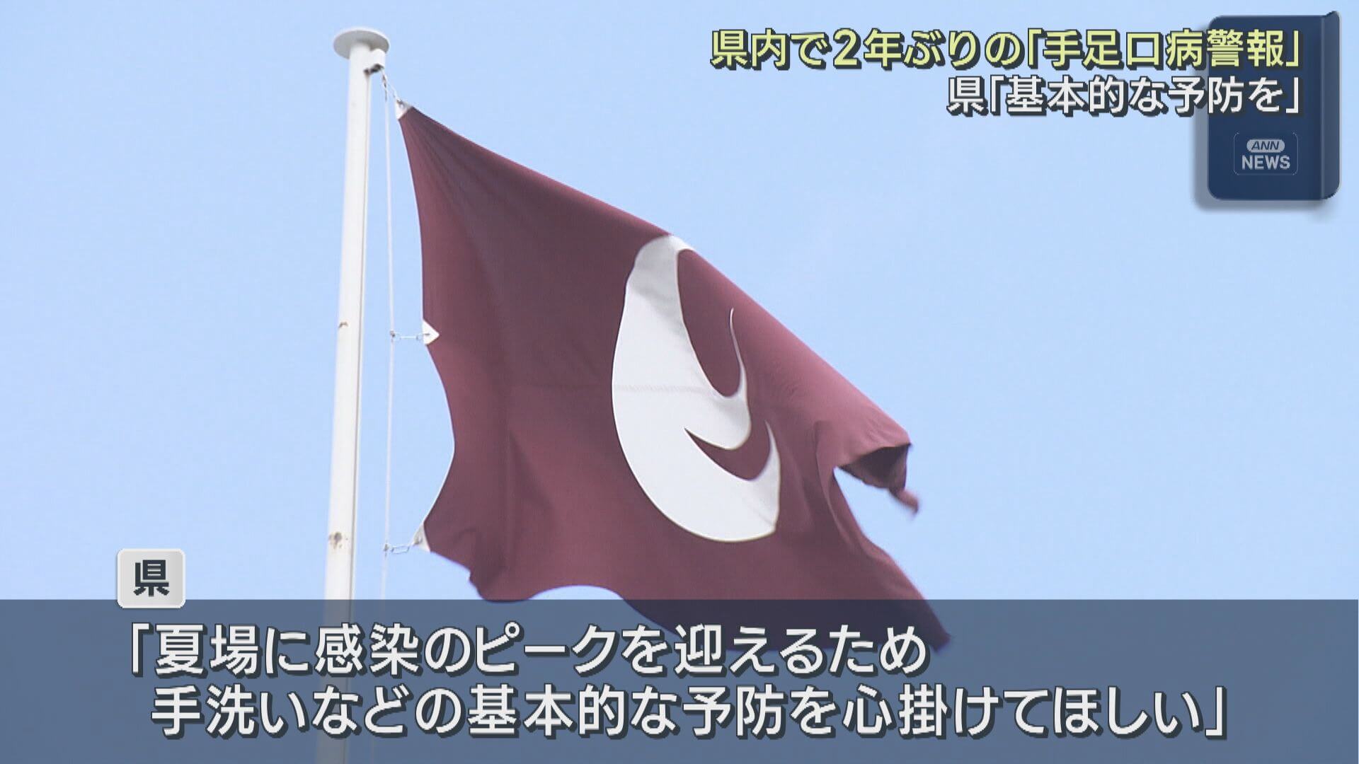 ２年ぶりに県内で「手足口病警報」夏場にピーク「基本的な感染予防を」　広島