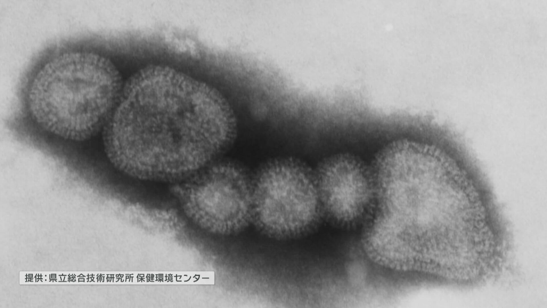 インフルエンザ　広島市も流行入り　去年より７週早く